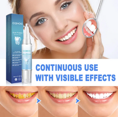 Close-up of My Store Teeth Repair Gel tube showing the product label and applicator tip on a white background.