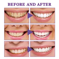 V34 Tooth Cleaning Mousse by My Store, close-up of foaming white mousse in a white dental container for oral hygiene.