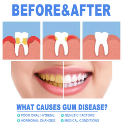 Teeth Repair Gel by My Store in a clear tube, ready for dental care, with a smooth, gel-like consistency visible in the image.