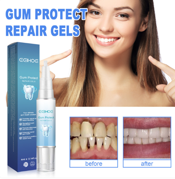 Teeth Repair Gel by My Store, showing a close-up of the gel tube with the gel applied on a dental model for tooth repair.